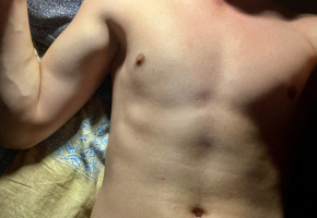 Привет, мне 18 лет девственник, ищу первый половой опыт с девушкой  – Фото 1